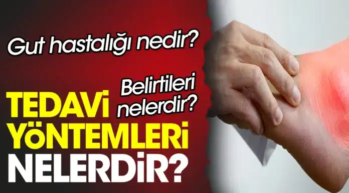 Gut Hastalığı İçin Beslenme Önerileri Nelerdir?
