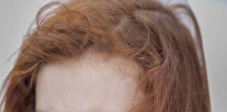 AHA ve BHA Asitlerinin Cilde Faydaları Nelerdir? AHA ve BHA Asitlerinin Cilde Faydaları Nelerdir?