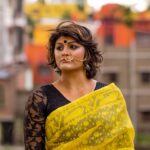 Akne İzleri İçin En Etkili Tedavi Yöntemleri Nelerdir? Cilt Yenileme Rehberi Akne İzleri İçin En Etkili Tedavi Yöntemleri Nelerdir?