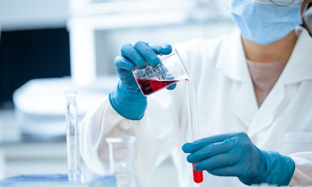 Kemik ve Eklem Sağlığı İçin Öneriler Nelerdir? Kemik ve Eklem Sağlığı İçin Öneriler Nelerdir?