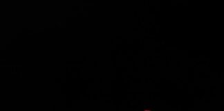 Saç Dökülmesine Karşı En Etkili Doğal Çözümler Nelerdir? Saç Dökülmesine Karşı En Etkili Doğal Çözümler Nelerdir?