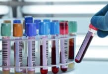 Sağlıklı Beslenme Programı İçin Yapılması Gereken Tetkikler