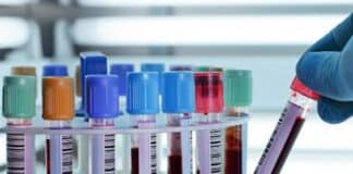 Sağlıklı Beslenme Programı İçin Yapılması Gereken Tetkikler