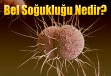 Bel Soğukluğu Nedir?