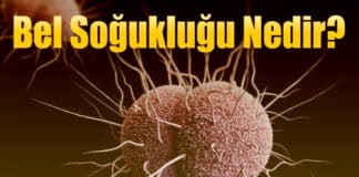 Bel Soğukluğu Nedir?